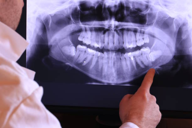 Best Knocked-Out Tooth Emergency  in Peaceful Valley, WA